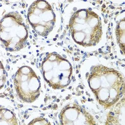 Anti-IFI44 antibody used in IHC (Paraffin sections) (IHC-P). GTX32667