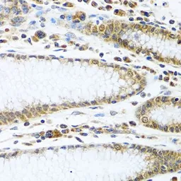 Anti-IFI44 antibody used in IHC (Paraffin sections) (IHC-P). GTX32667