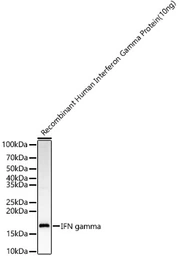 Anti-Interferon gamma antibody used in Western Blot (WB). GTX32669