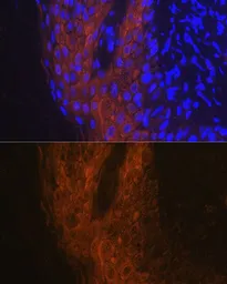 Anti-IL1 Receptor antagonist antibody used in IHC (Paraffin sections) (IHC-P). GTX32673