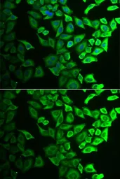 Anti-IL18BP antibody used in Immunocytochemistry/ Immunofluorescence (ICC/IF). GTX32676