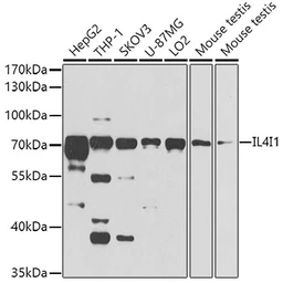 Anti-IL4I1 antibody used in Western Blot (WB). GTX32678