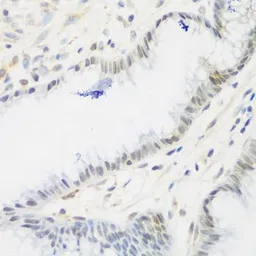 Anti-IMP3 antibody used in IHC (Paraffin sections) (IHC-P). GTX32680