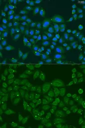 Anti-SKIP antibody used in Immunocytochemistry/ Immunofluorescence (ICC/IF). GTX32681