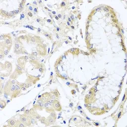Anti-SKIP antibody used in IHC (Paraffin sections) (IHC-P). GTX32681