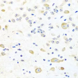Anti-SKIP antibody used in IHC (Paraffin sections) (IHC-P). GTX32681
