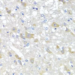 Anti-SKIP antibody used in IHC (Paraffin sections) (IHC-P). GTX32681