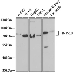 Anti-INTS10 antibody used in Western Blot (WB). GTX32682