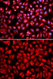 Anti-IPO5 antibody used in Immunocytochemistry/ Immunofluorescence (ICC/IF). GTX32684