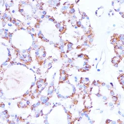 Anti-ISG15 antibody used in IHC (Paraffin sections) (IHC-P). GTX32686