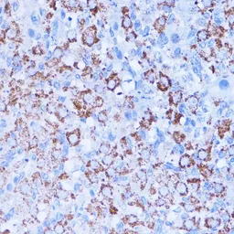 Anti-ISG15 antibody used in IHC (Paraffin sections) (IHC-P). GTX32686