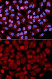 Anti-JNK2 antibody used in Immunocytochemistry/ Immunofluorescence (ICC/IF). GTX32689