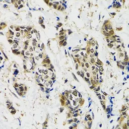 Anti-JNK2 antibody used in IHC (Paraffin sections) (IHC-P). GTX32689