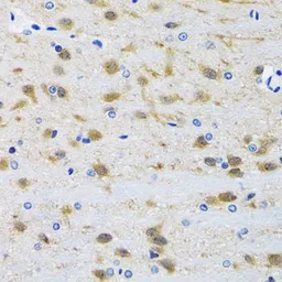 Anti-JNK2 antibody used in IHC (Paraffin sections) (IHC-P). GTX32689