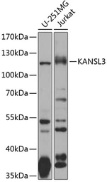 Anti-KIAA1310 antibody used in Western Blot (WB). GTX32691