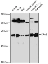 Anti-K-Ras antibody used in Western Blot (WB). GTX32694