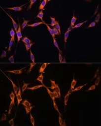 Anti-K-Ras antibody used in Immunocytochemistry/ Immunofluorescence (ICC/IF). GTX32694