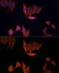 Anti-K-Ras antibody used in Immunocytochemistry/ Immunofluorescence (ICC/IF). GTX32694