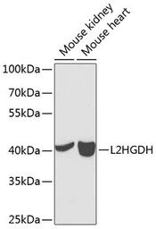 Anti-L2HGDH antibody used in Western Blot (WB). GTX32695