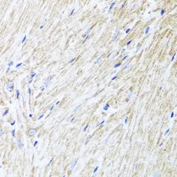 Anti-L2HGDH antibody used in IHC (Paraffin sections) (IHC-P). GTX32695