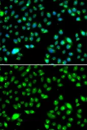 Anti-L3MBTL3 antibody used in Immunocytochemistry/ Immunofluorescence (ICC/IF). GTX32696