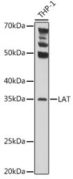 Anti-LAT antibody used in Western Blot (WB). GTX32700