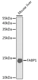 Anti-L-FABP antibody used in Western Blot (WB). GTX32704