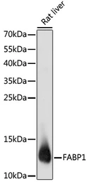 Anti-L-FABP antibody used in Western Blot (WB). GTX32704