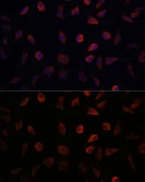 Anti-L-FABP antibody used in Immunocytochemistry/ Immunofluorescence (ICC/IF). GTX32704