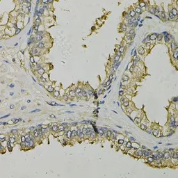 Anti-L-FABP antibody used in IHC (Paraffin sections) (IHC-P). GTX32704