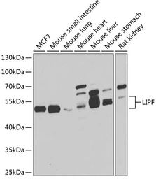 Anti-LIPF antibody used in Western Blot (WB). GTX32705