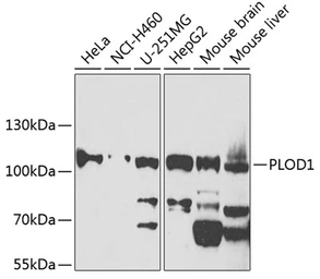 Anti-LH1 antibody used in Western Blot (WB). GTX32707