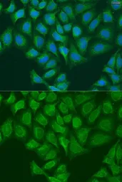 Anti-LH1 antibody used in Immunocytochemistry/ Immunofluorescence (ICC/IF). GTX32707
