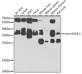 Anti-Macro H2A.1 antibody used in Western Blot (WB). GTX32709