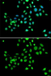 Anti-Macro H2A.1 antibody used in Immunocytochemistry/ Immunofluorescence (ICC/IF). GTX32709