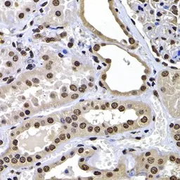 Anti-Macro H2A.1 antibody used in IHC (Paraffin sections) (IHC-P). GTX32709