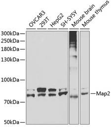 Anti-MAP2 antibody used in Western Blot (WB). GTX32712