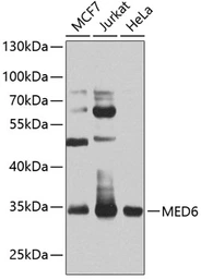 Anti-MED6 antibody used in Western Blot (WB). GTX32718