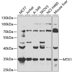 Anti-Metaxin-1 antibody used in Western Blot (WB). GTX32719