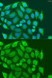 Anti-Metaxin-1 antibody used in Immunocytochemistry/ Immunofluorescence (ICC/IF). GTX32719