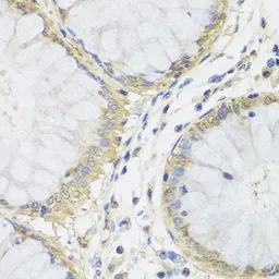 Anti-Metaxin-1 antibody used in IHC (Paraffin sections) (IHC-P). GTX32719