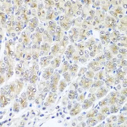 Anti-Metaxin-1 antibody used in IHC (Paraffin sections) (IHC-P). GTX32719