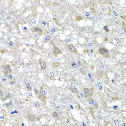 Anti-Metaxin-1 antibody used in IHC (Paraffin sections) (IHC-P). GTX32719