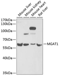 Anti-MGAT1 antibody used in Western Blot (WB). GTX32720
