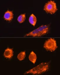 Anti-MGAT1 antibody used in Immunocytochemistry/ Immunofluorescence (ICC/IF). GTX32720
