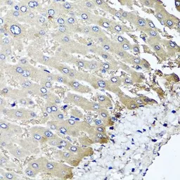 Anti-MGAT1 antibody used in IHC (Paraffin sections) (IHC-P). GTX32720