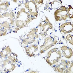 Anti-MGAT1 antibody used in IHC (Paraffin sections) (IHC-P). GTX32720
