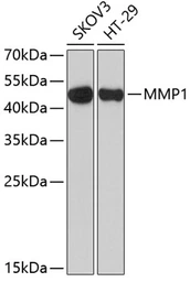 Anti-MMP1 antibody used in Western Blot (WB). GTX32723
