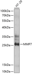 Anti-MMP7 antibody used in Western Blot (WB). GTX32725