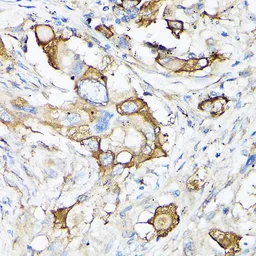 Anti-MMP7 antibody used in IHC (Paraffin sections) (IHC-P). GTX32725